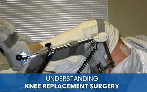 knee replacement surgery risks and complications