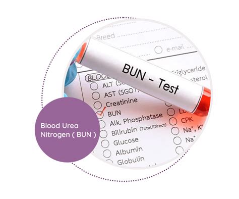 lab bun blood test