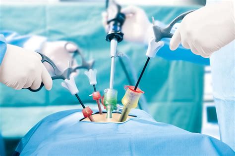 laparoscopic surgery
