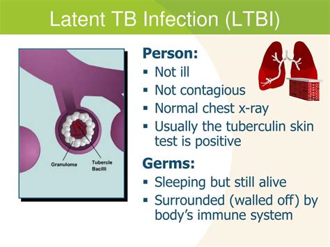 latent tuberculosis infection