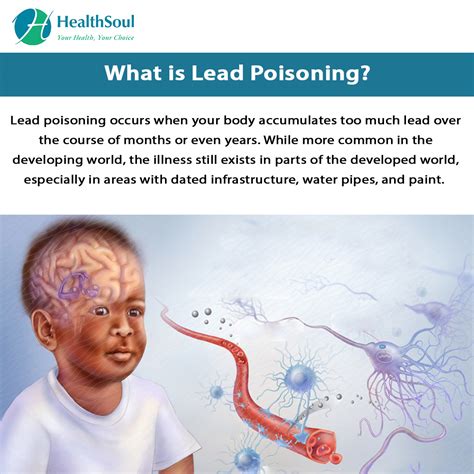 Lead Poisoning Effects