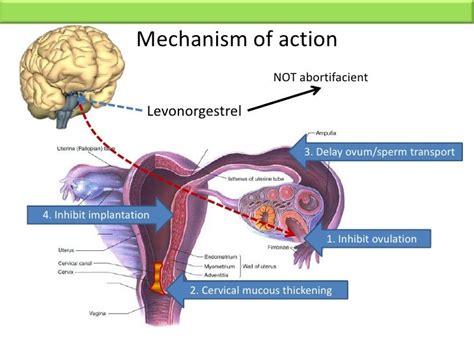 levonorgestrel mechanism image