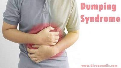 Lifestyle Changes for Dumping Syndrome