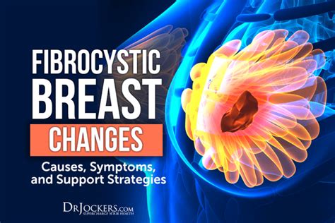 lifestyle modifications for fibrocystic breast disease