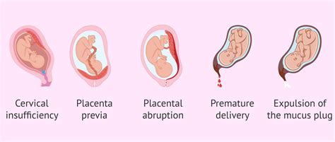 light spotting during pregnancy