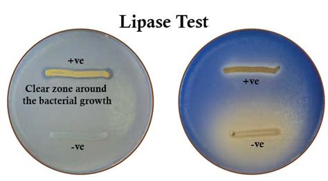 Lipase Test Results