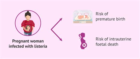 Listeria Symptoms in Pregnancy
