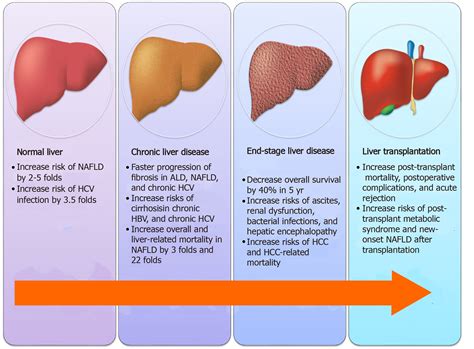 Liver Disease Diagnosis and Management