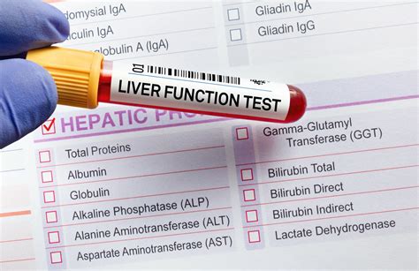 Liver Function Test Preparation