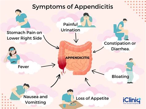 living with appendicitis illustration