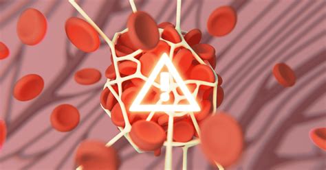 living with blood clots