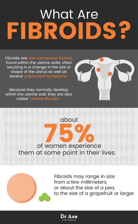 Living with fibroids