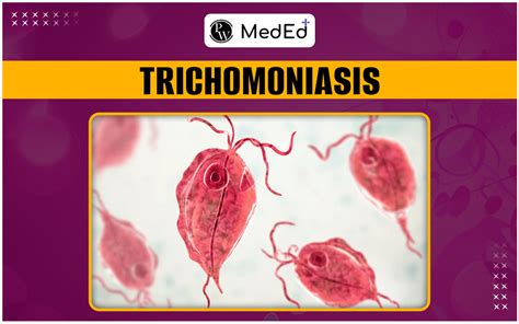Living with Trichomoniasis