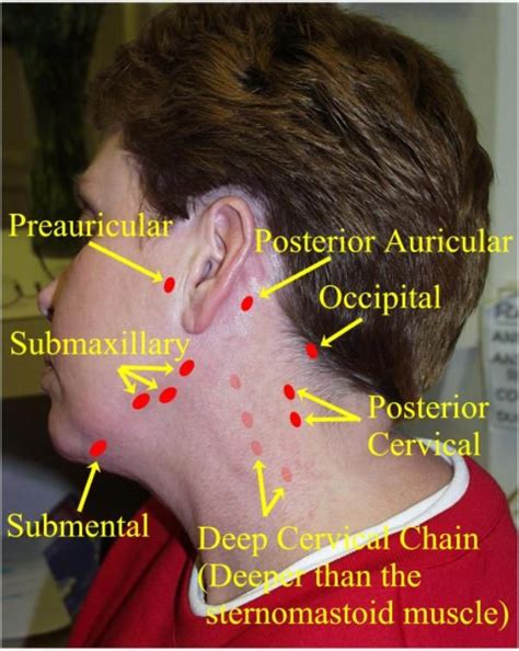 Locations of Neck Lymph Nodes