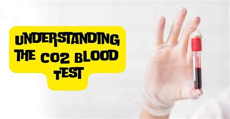Low CO2 Blood Test