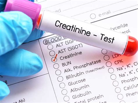 Low Creatinine Blood Test Results