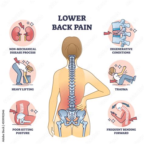 Lumbar back ache causes