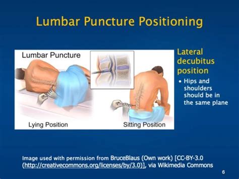 Lumbar Puncture Training