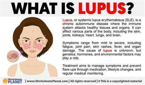 lupus