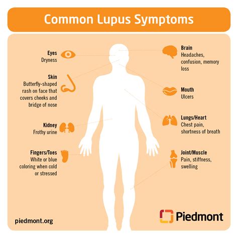 Lupus Causes