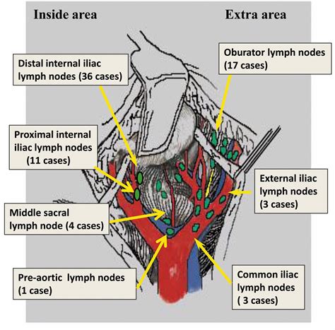 lymph glands groin