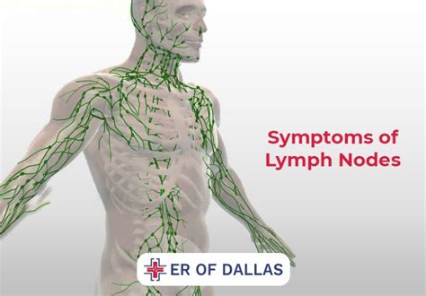 Lymph Node Diagnosis
