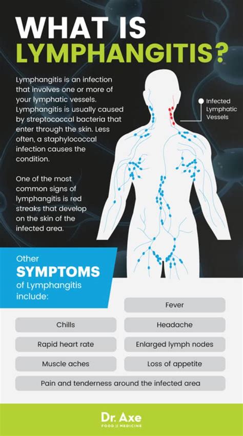 lymph node infection signs