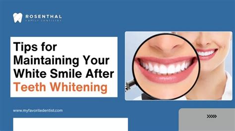 Maintaining a White Smile