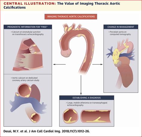 Managing Atherosclerosis and Aortic Disease