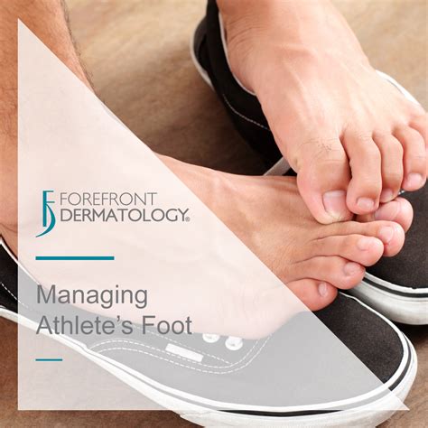 Tips for managing athlete's foot