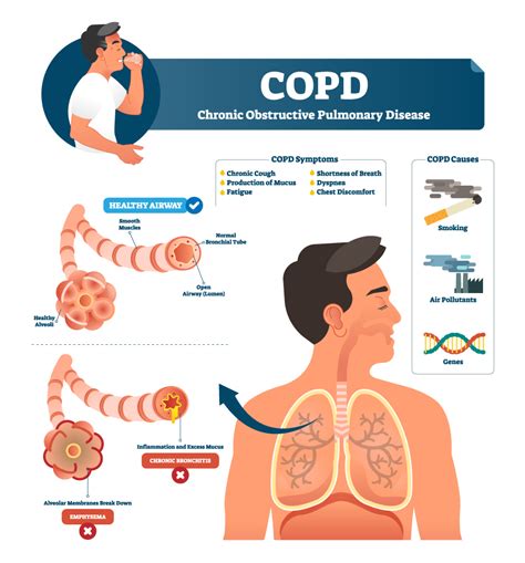 Managing COPD Symptoms