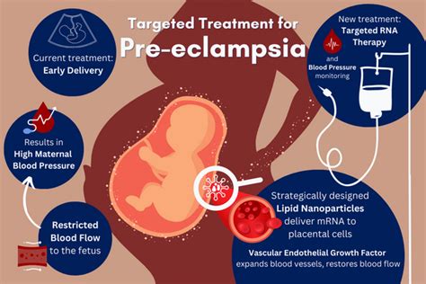 managing preeclampsia