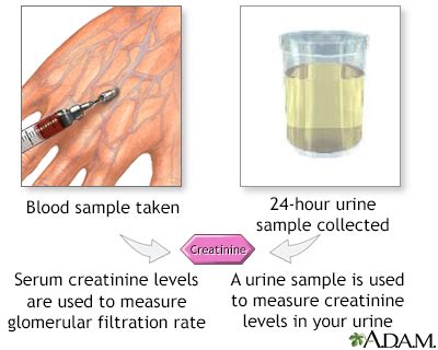 Managing Urine Creatinine Levels