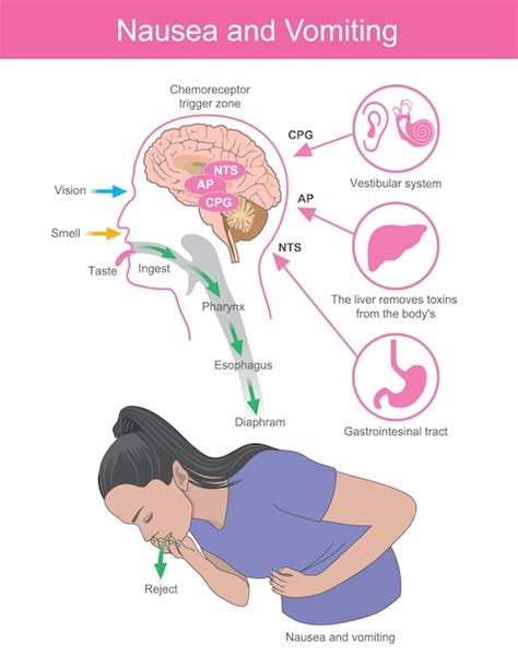 Managing Vomiting Symptoms