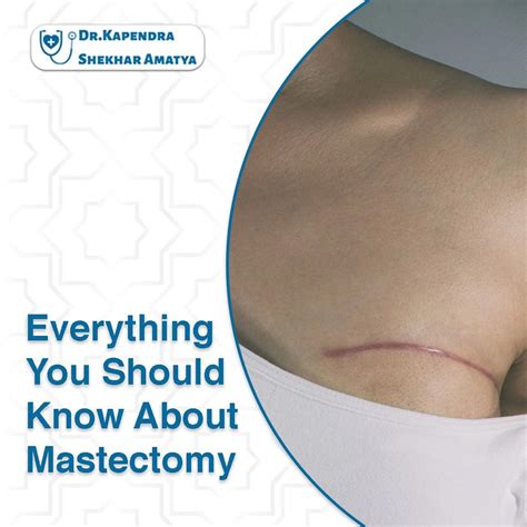 Mastectomy