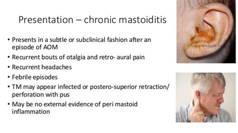 Mastoiditis complications
