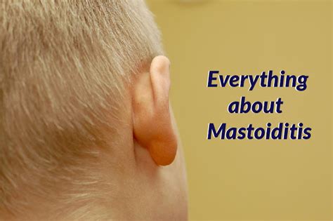 Mastoiditis research and developments