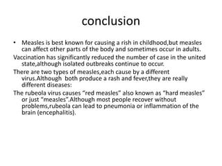 Measles Conclusion
