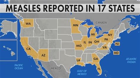 Measles Outbreaks