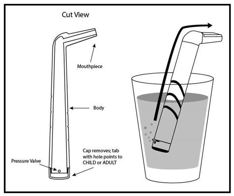 medical interventions for hiccups