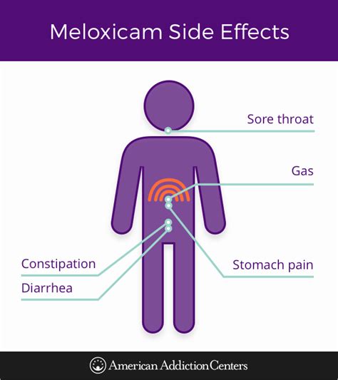 Meloxicam 7.5 Mg Tablet Side Effects