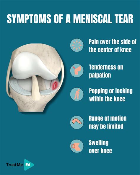 Meniscus Tear