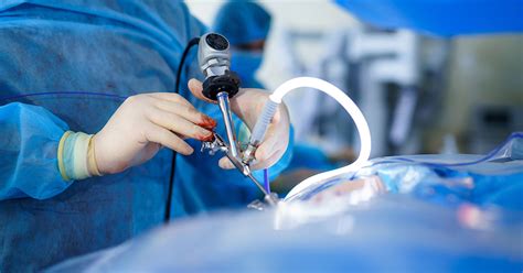 Minimally Invasive Surgery
