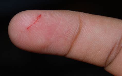 Calamine lotion for minor cuts and scrapes