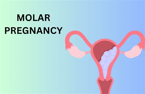 molar pregnancy treatment