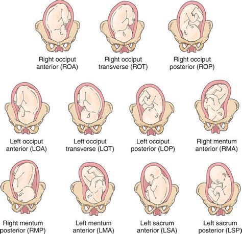Monitoring and Managing Baby Positions