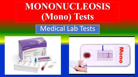 mono blood test results