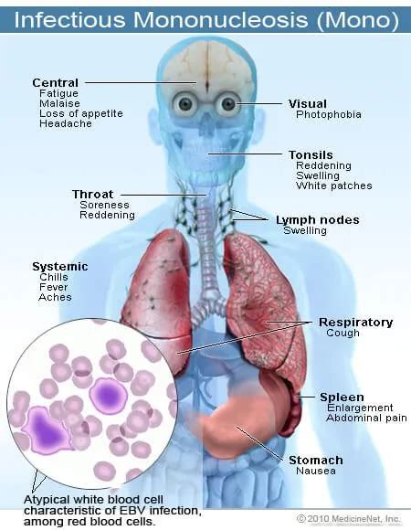 mono blood test risks
