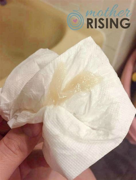Mucus Plug Appearance Image