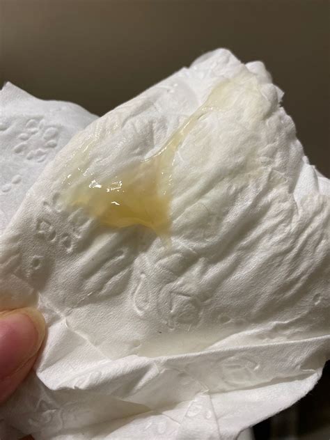 Mucus Plug Labor Image
